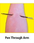 pen in arm